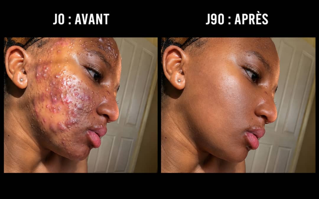 Aïcha D. — transformation avant / après
