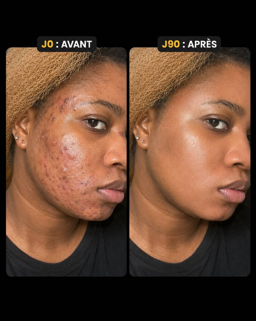 Marthe K. — transformation avant / après