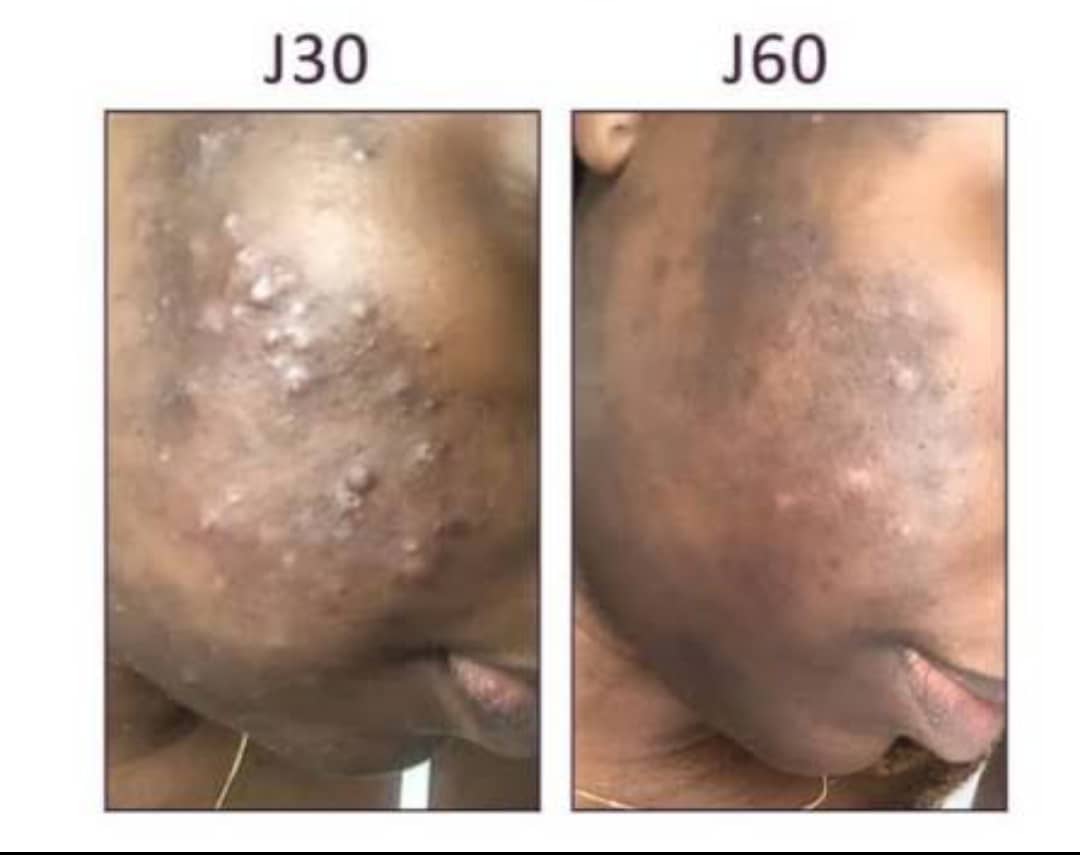 Nathalie — transformation avant / après