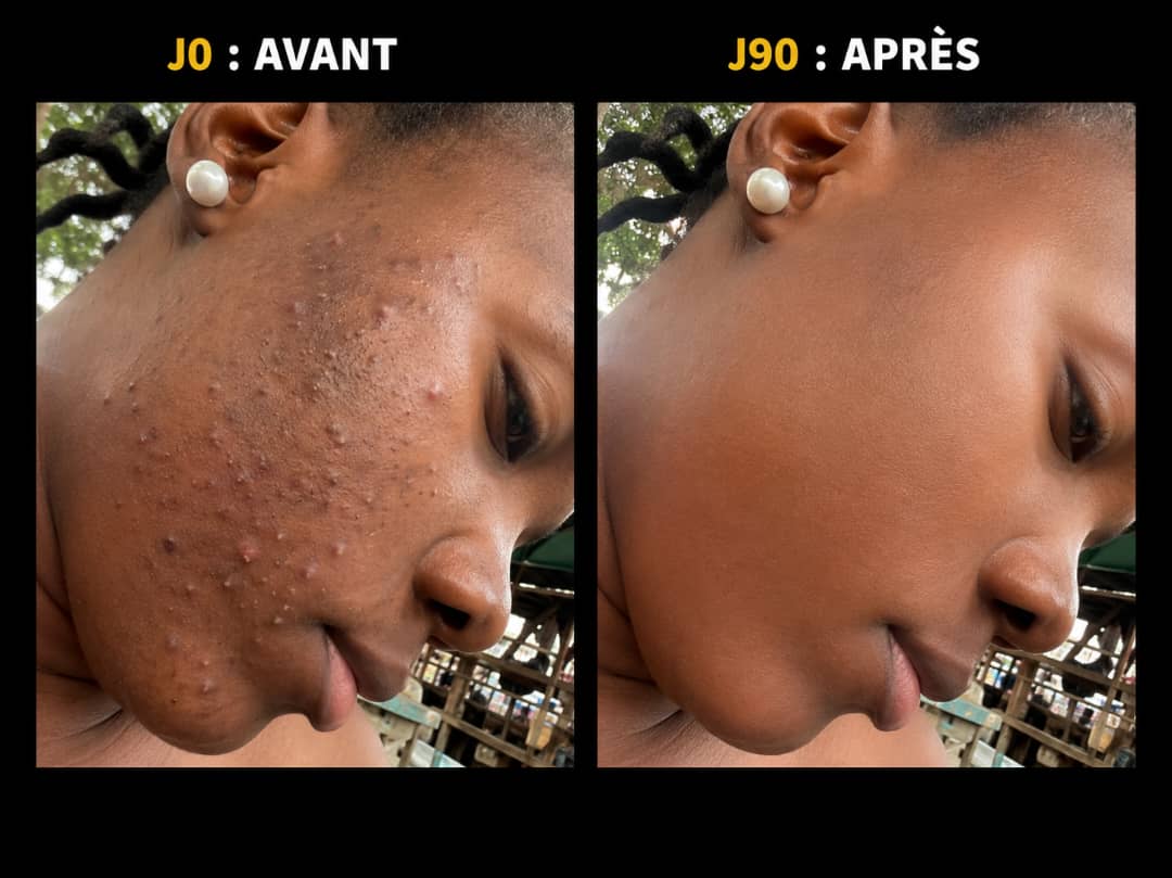Solange N. — transformation avant / après